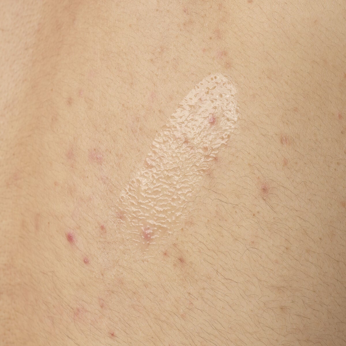 salicylic-acid-0-5-body-serum-m8 ORD-salicylic-acid-05-body-240ml-application.jpg