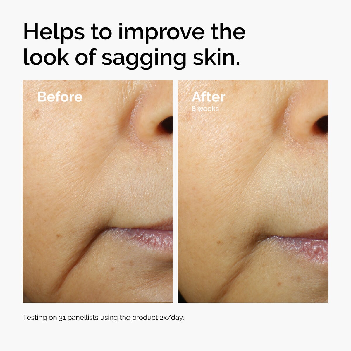 caffeine-3-escin-1-face-serum-i1 ord-caffeine-3pct-escin-1pct-face-serum-before-after-sagging.jpg