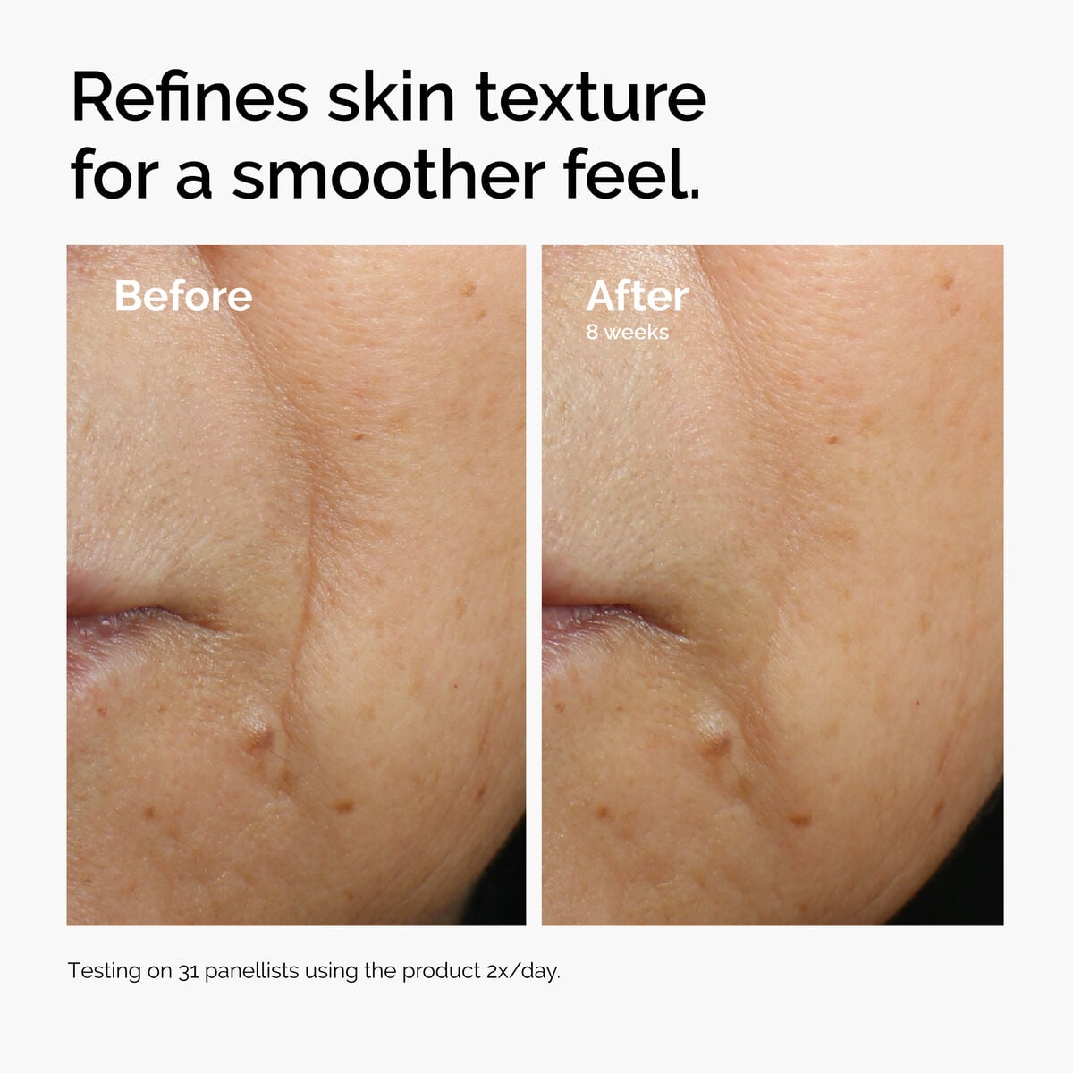 caffeine-3-escin-1-face-serum-i1 ord-caffeine-3pct-escin-1pct-face-serum-before-after-texture.jpg