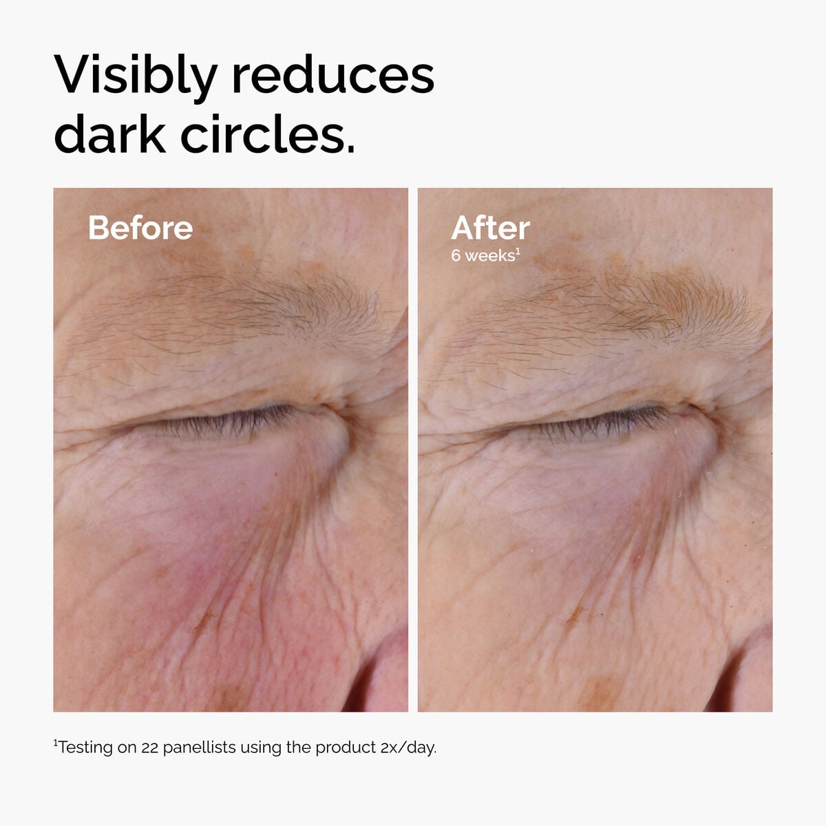 caffeine-solution-5-egcg-eye-serum-k6 ord-caffeine-solution-egcg-dark-circles-before-after.jpg