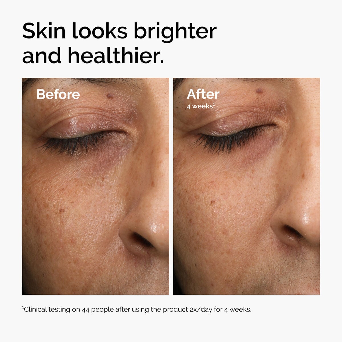 multi-antioxidant-radiance-serum-v9 ord-mars-before-after-healthy.jpg