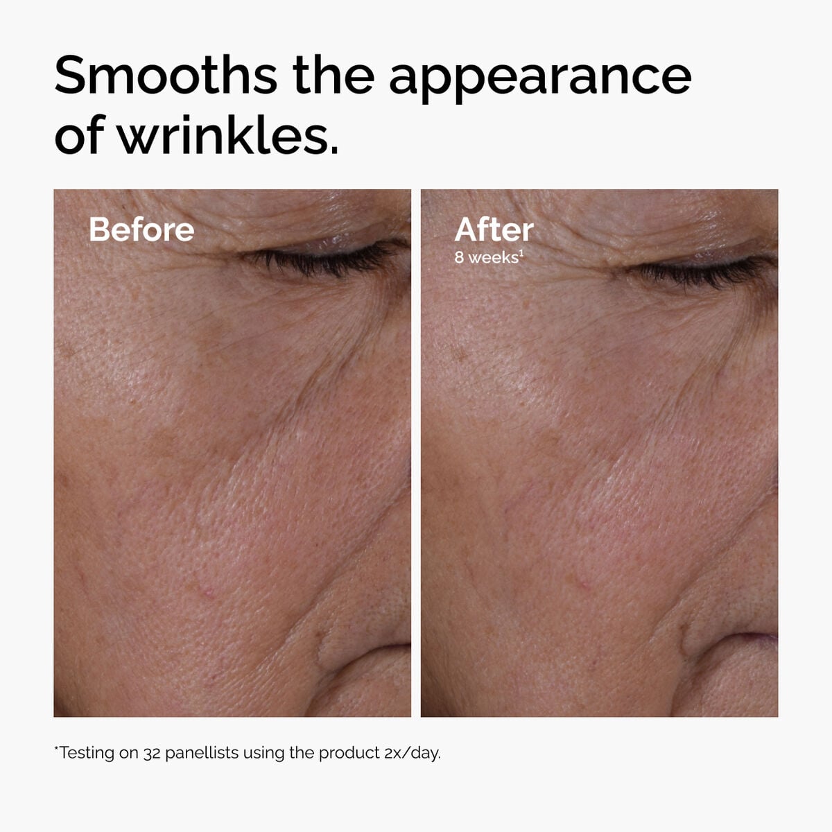 multi-peptide-ha-serum-u5 ord-multi-peptide-ha-serum-wrinkles-before-after.jpg