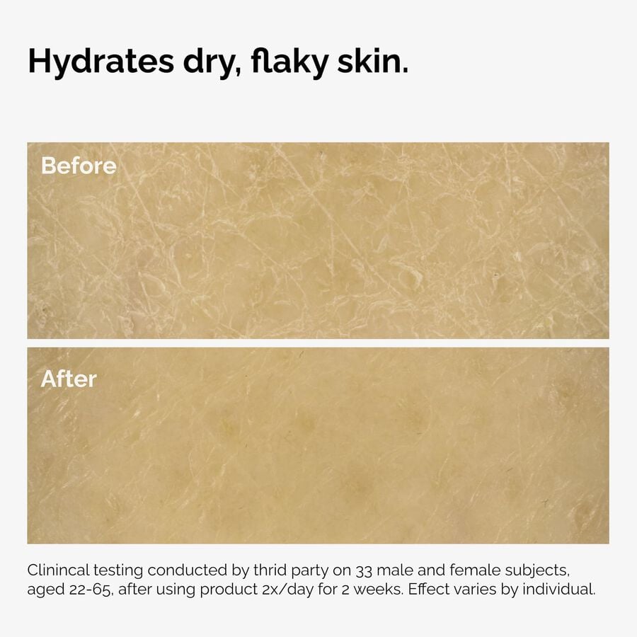 the-body-care-collection-i6 ord-natural-moisturizing-factors-inulin-body-before-after-graphic-02.jpg