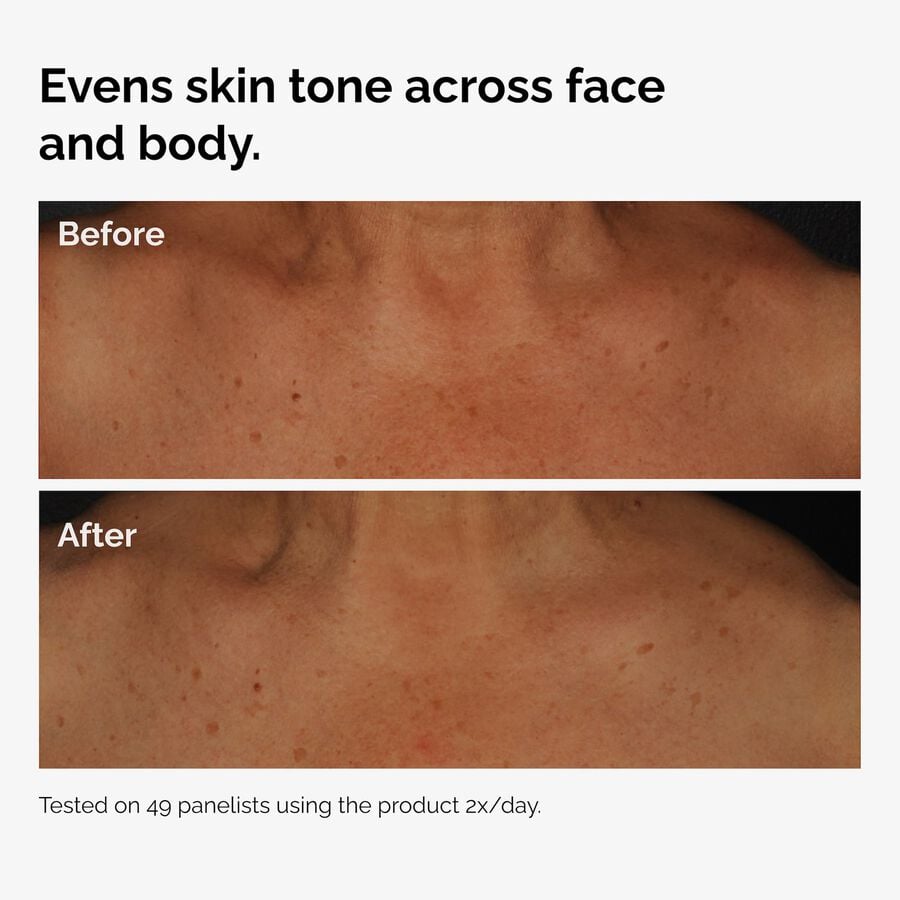 the-body-care-collection-i6 ord-niacinamide-face-body-serum-before-after-even-tone-graphic.jpg