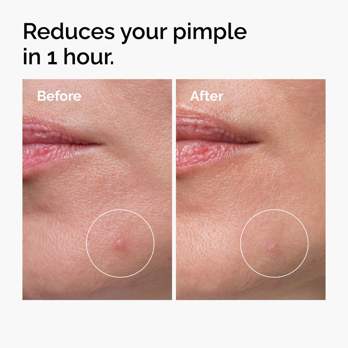 sulfur-10-powder-to-cream-concentrate-n1 ord-sulfur-10pct-powder-to-cream-concentrate-before-after-NA.jpg